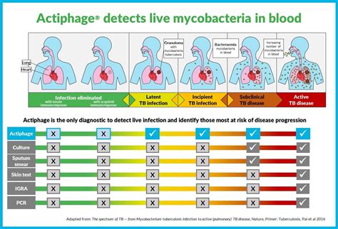 TB (Tuberculosis) Test: Purpose, Procedure.